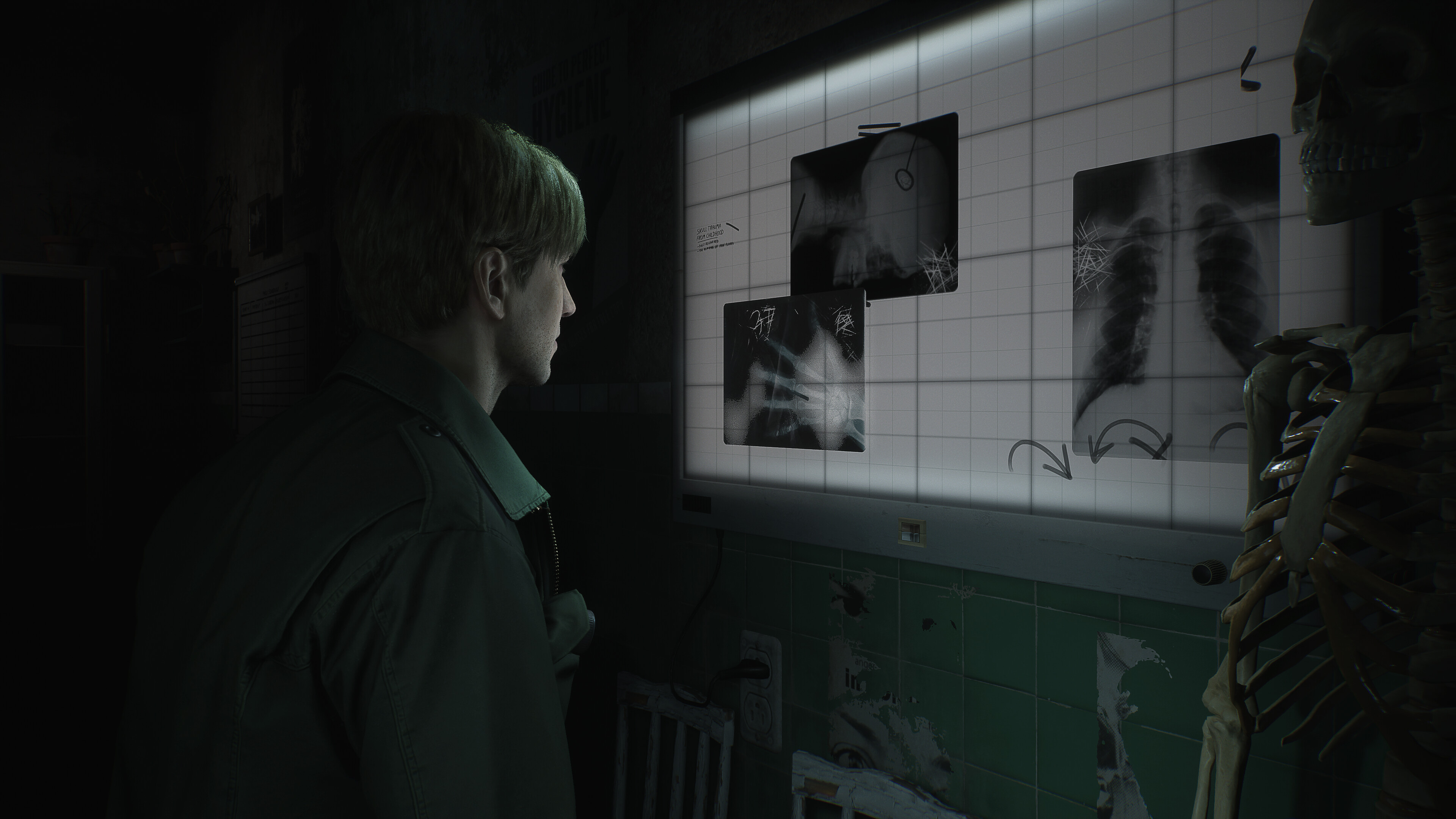 Silent Hill 2 Remake PC Requirements Revealed